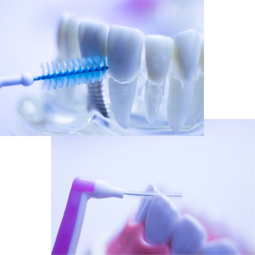 介護 誤嚥性肺炎